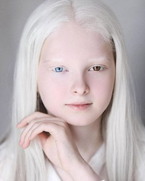 Albino People, Albino Girl, White Blonde Hair, Photographie Portrait Inspiration, White Blonde, Shooting Photo, Ethereal Beauty, White Hair, Beautiful Eyes