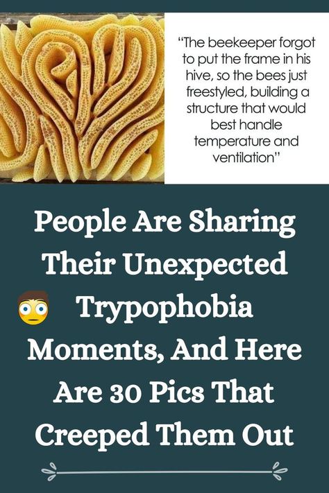 People Are Sharing Their Unexpected Trypophobia Moments, And Here Are 30 Pics That Creeped Them Out Tryphobia Pictures, Trypophobia Skin, He Hive, The Fear, Bee Keeping, In This Moment