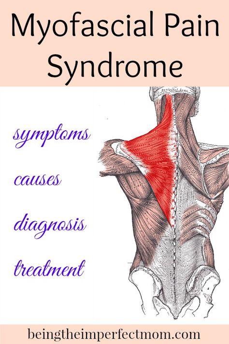 Myofascial Pain Syndrome, Chronic Fatigue Symptoms, Myofascial Release, Connective Tissue, Chronic Fatigue, Muscle Pain, Migraine, Many People, Chronic Pain