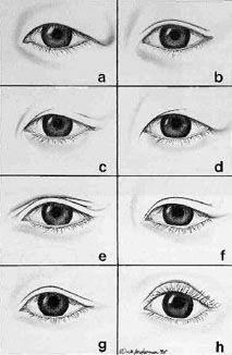 Types of Asian eyelids Monolid Vs Double Eyelid, How To Draw Hooded Eyes, Monolid Eyes Drawing, Hooded Eye Drawing, Hooded Eyes Drawing, Eyelids Drawing, Eyelid Types, Asian Double Eyelid, Caucasian Makeup