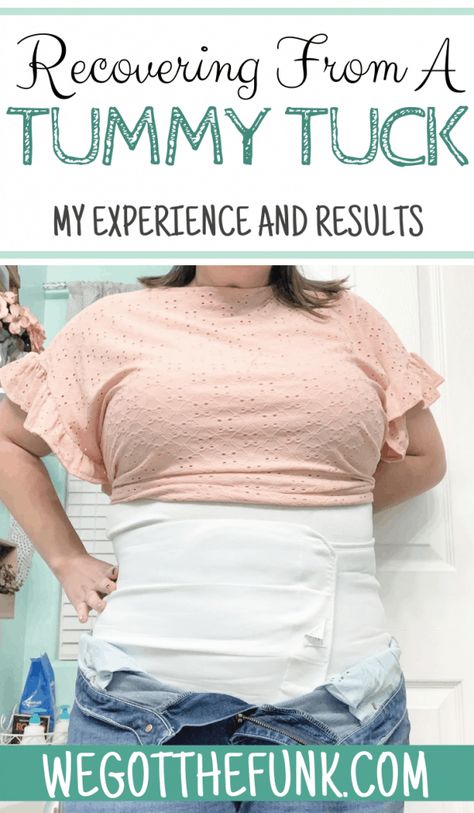 I had a drainless tummy tuck completed in Colorado and am sharing my recovery from a tummy tuck with results and what to expect. Plus Size Mommy Makeover Surgery, Diastasis Recti Surgery Before And After, Tummy Tucks Recovery Timeline, Tummy Tucks Post Op, Tummy Tucks Recovery List, Plus Size Tummy Tucks Before And After, Sono Bello Before And After, Tummy Tucks Recovery Tips, Mommy Makeover Surgery Before And After Tummy Tucks