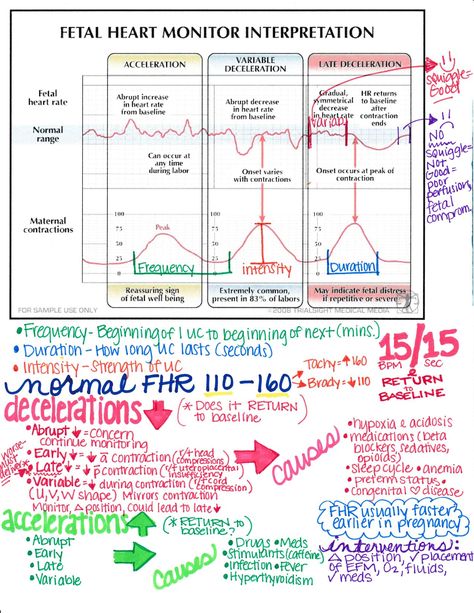 Pediatric Nursing Mnemonics, Labor And Delivery Nurse Cheat Sheet, Maternal Newborn Nursing Study Guide, Ob Nursing Student Cheat Sheets, Maternity Nursing Study, Fetal Heart Monitoring, Peds Nursing, Nursing School Studying Cheat Sheets, Obstetrics Nursing