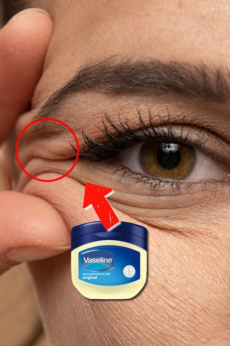 Vaseline Under Eyes, Baking Soda Under Eyes, Vaseline Uses For Face, Vaseline For Face, Eyelid Wrinkles, Eyes Wrinkles, Wrinkles Remedies Face, Jawline Exercise, Baking Soda Face Mask