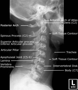 Anatomy Labeled, Radiographic Anatomy, Radiology Schools, Punkty Spustowe, Radiologic Technology, Medical Items, Radiology Student, Radiology Imaging, Radiology Technologist