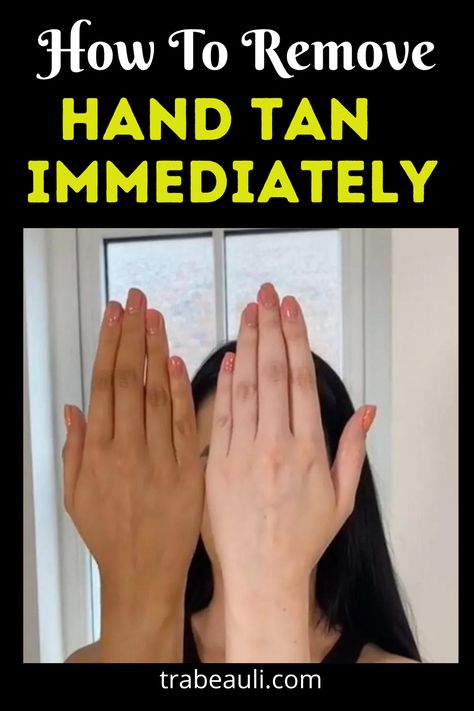 Hand Tan At Home Immediately How To Get Rid Of Sun Tan On Face, Remedy For Tanned Hands, How To Remove Tan From Hand And Face, How To Brighten Hands At Home, Hands Tan Removal At Home, Tan Remove From Hands, How To Remove Hand Hair, How To Remove Hand Tanning, How To Remove Skin Tanning