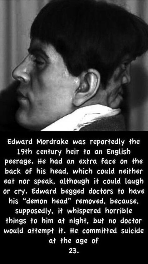 Edward Mordrake Edward Mordrake, Interesting History, Two Faces, Scary Stories, American Horror, Horror Stories, American Horror Story, True Stories, Just In Case