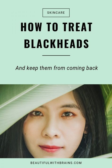 How To Treat Blackheads (And Keep Them From Coming Back) How To Treat Blackheads, How To Prevent Blackheads, Skincare Acne, Cold Sores Remedies, Natural Sleep Remedies, Natural Cold Remedies, Losing 40 Pounds, Natural Cough Remedies, Cold Home Remedies