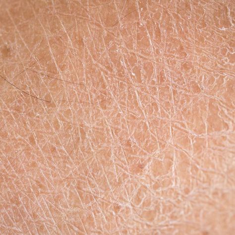 various skin conditions INFO Skin Disease Pictures, Dry Scaly Skin, Remove Skin Tags Naturally, Skin Facts, Mole Removal, Magnesium Benefits, Scaly Skin, Types Of Acne, Skin Tags