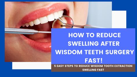 How To Reduce Swelling After Wisdom Teeth Surgery Fast! Teeth Surgery, Wisdom Tooth Extraction, Tooth Extraction, Cracked Lips, Wisdom Teeth, Best Masks, Improve Circulation, Deep Tissue, Lip Mask