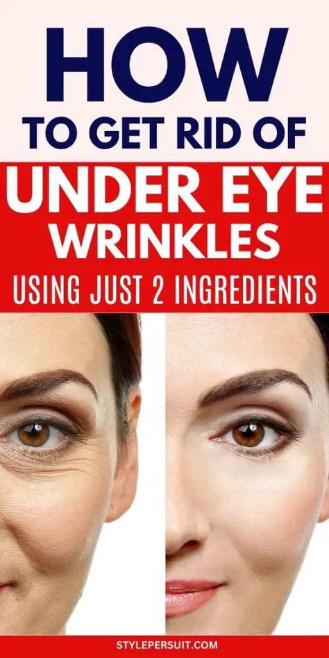 UNDER EYE WRINKLES REMEDIES Wrinkles Under Eyes Remedies, Under Eye Circles Remedies, Natural Eye Wrinkle Remedies, Under Eye Care Routine, How To Remove Eye Wrinkles, Wrinkles Around The Eyes, How To Remove Wrinkles Under Eyes, Eyes Wrinkles Remedies, Wrinkles Under Eyes Get Rid Of