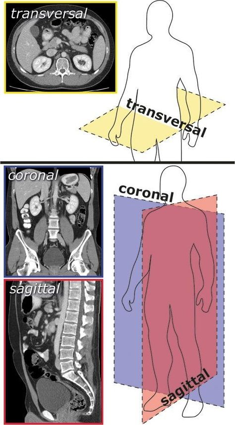 Medical Terminology Study, Radiology Student, Diagnostic Medical Sonography, Kedokteran Gigi, Studying Medicine, Medical School Life, Nursing School Motivation, Medicine Notes, Basic Anatomy And Physiology