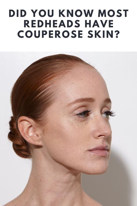 Did You Know Most Redheads Have Couperose Skin? Redhead Color Analysis, Redhead Cool Skin Tone, Ginger Hair On Cool Skin, Colors For Red Heads To Wear, Fair Skin Natural Makeup, Blending Gray Hair Redhead, Cool Skin Red Hair, Best Clothing Colors For Gingers, Clothing Colors For Redheads