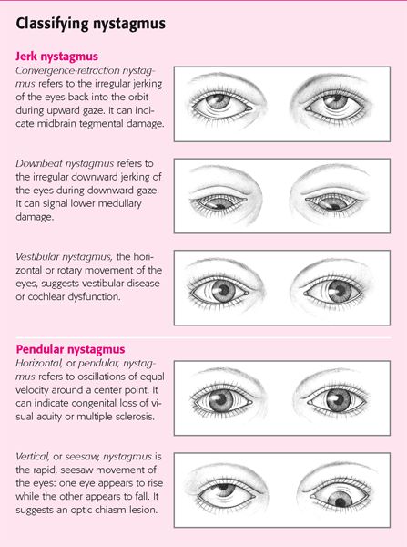 Opthalmic Technician, Optometry Education, Eye Conditions, Eye Anatomy, Eye Facts, Vision Therapy, Eyes Problems, Qi Gong, Medical Knowledge