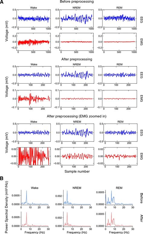 SlumberNet: deep learning classification of sleep stages using residual neural networks | Scientific Reports Sleep Stages, Rem Sleep, When You Sleep, Sleep Pattern, School Of Medicine, Sleep Deprivation, Deep Learning, A Novel, Sleep