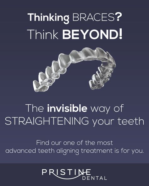 Aligners For Teeth, Dental Aligners, Invisible Aligners, Dental Social Media, Dental Images, Teeth Alignment, Dental Posters, Social Media Branding Design, Dental Marketing