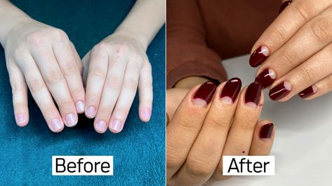 After 25 Years of Biting My Nails, I Think I’ve Finally Found a Solution — See My Before & After Photos | Allure Before After Nails, Nail Biting Habit, Best Summer Nail Color, Popular Nail Designs, Nail Biting, How To Grow Nails, Get Nails, Nail Health, Summer Nails Colors