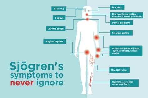 Sjögren’s Syndrome Symptoms You Might Be Ignoring Autoimmune Disease Symptoms, Nerve Problems, Skin Symptoms, Chronic Cough, Sjogrens Syndrome, Pulmonary Disease, Autoimmune Disorder, Dental Problems, Dry Eyes