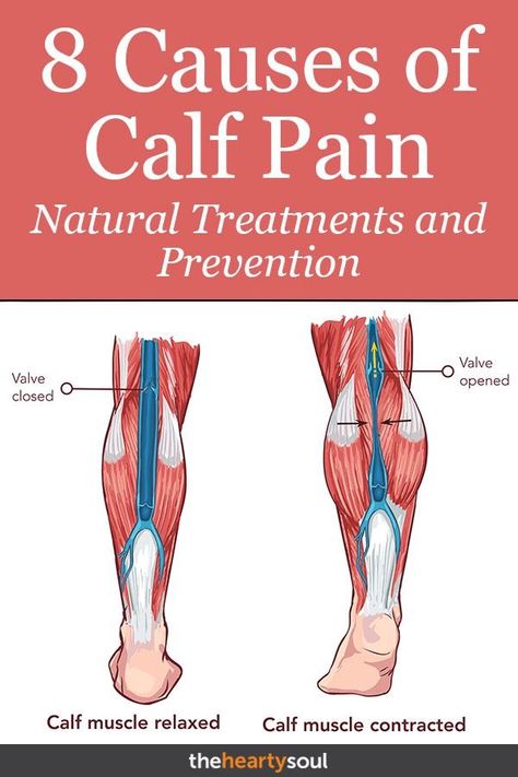 Sore Calf Muscles, Stretch Calf Muscles, Calf Muscle Pain, Sore Calves, Leg Cramps At Night, Muscles Anatomy, Calf Pain, Calf Cramps, Anatomy Physiology