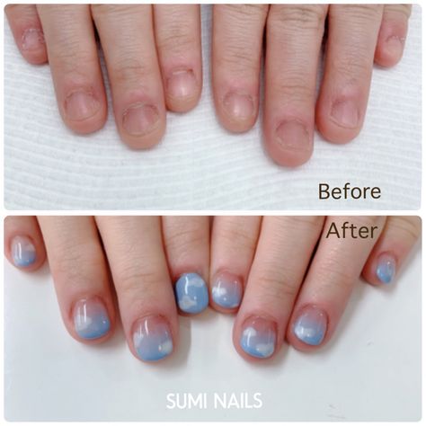 If you have bitten nails, we like to support you to stop the bad habit and grow a healthy nails!! Don’t be embarrassed! We are here to help♡ #bittennails #acrylicextention #skynails #clouds #suminails #beforeandafter #ladiposh #japanesenailsalon Bitten Nails, Nails Healthy, Korean Nail, Korean Nail Art, Sky Nails, Extension Designs, Korean Nails, Short Nails Art, Nail Biting