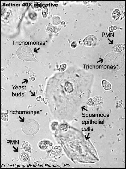 Trichomonas vaginalis Medical Lab Technician, Vet Tech School, Vet Tech Student, Medical Laboratory Technician, Vet Technician, Microbiology Lab, Clinical Chemistry, Medical Laboratory Scientist, Laboratory Technician