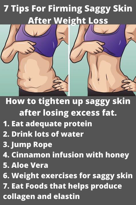 An image showing a saggy skin resulting from excess weight loss and a second image showing tightened skin as corrected by applying the 7 tips for firming saggy skin after weight loss. Loose Belly, Tighten Loose Skin, Lose Thigh Fat, Excess Skin, Saggy Skin, Loose Skin, Sagging Skin, Skin Tightening, Star Wars