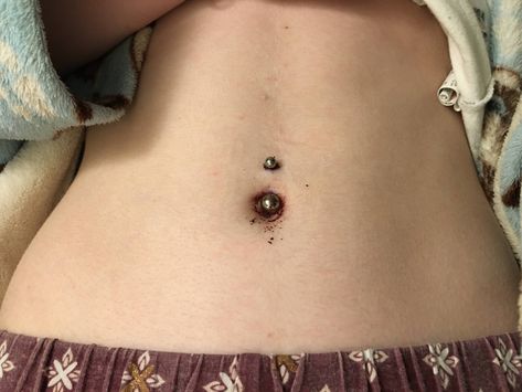 fresh belly button piercing crusted blood Belly Button Piercing Aesthetic, Piercing Aesthetic, Microdermal Piercing, Food Makeup, Bellybutton Piercings, Clothing Board, Belly Piercing Jewelry, Piercing Inspo, Button Piercing