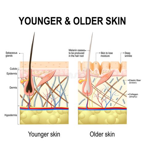 Skin changes or ageing skin. stock illustration Skin Anatomy, Old Skin, Skin Facts, Collagen Fibers, Human Anatomy And Physiology, Younger Skin, Boost Collagen Production, Deep Wrinkles, Anatomy And Physiology