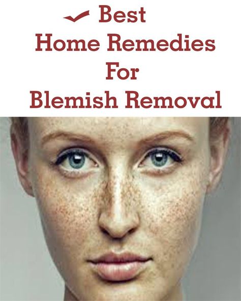 How To Remove Blemishes From Face, Blemishes On Face Remedies, Remove Blemishes From Face, Blemish Remedies, Hormonal Imbalances, Coffee Face Scrub, Prevent Pimples, Dark Spots On Face, Face Home