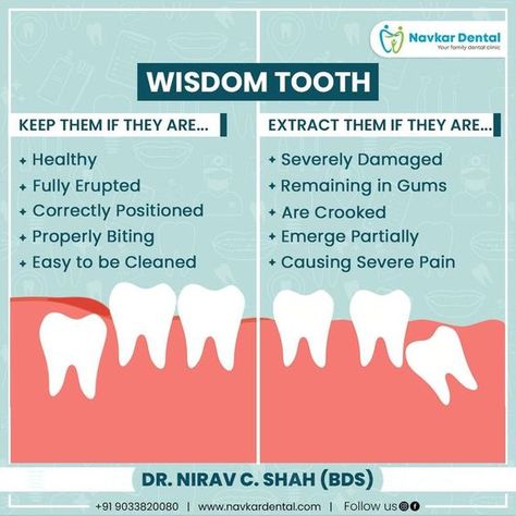 Wisdom Tooth Quotes On Doctors, Dentist Tips, Dentistry Quotes, Dental Post, Dental Ads, Dental Quotes, Dental Advertising, Dentist Art, Dental Photos