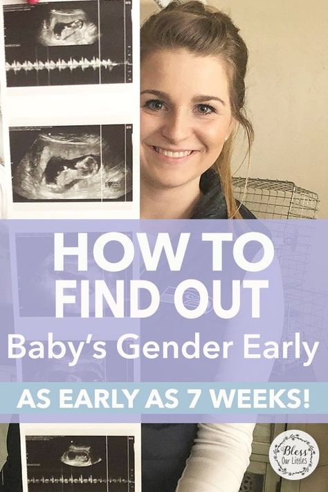 Knowing whether you are having a boy and girl can be exciting. If you are as impatient as I am... you HAVE to try this at home Gender Detection Test to know baby gender early! #GenderTest #FindOutBabyGender #GenderDNATest Ramsey Theory Baby Gender, Gender Test At Home, Ring Test Gender Prediction, Girl Or Boy Predictions, Boy Or Girl Prediction Signs, Heartbeat Gender Prediction, Ultrasound Boy Or Girl, 7 Weeks Pregnant Ultrasound, At Home Gender Test