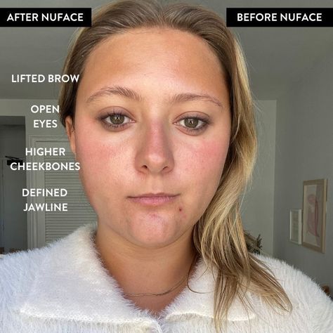 Our Beauty Editor has tried countless beauty products, but one reigns supreme above all others: the NuFACE Mini Toning Device. Here's why: #NuFACE #NuFACEreview #skincareproducts #antiaging #skincareroutine #skincareadvice #beautyroutine #favoriteskincareproducts Nuface Mini How To Use, Nuface How To Use, Nuface Before And After, Nuface Mini, Gel Primer, High Cheekbones, Beauty Gadgets, Diy Hair Care, The Everygirl