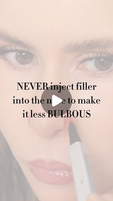 Dr Rebecka Gardell on Instagram: "Shrink your bulbous nose without surgery 👇🏽

1. Botox to make the muscle layer thinner - final results takes several months to see (effect can be quite dramatic)

2. RF microneedling/Morpheus 8 with the correct depth and setting can slim the fatty layer in the nose. Results are seen after 3-4 treatments

3. Trerinoin or isotretinoin shrinks the sebaceous glands which with time can give appearance of a more narrow nose (effect can be quite dramatic)" Morpheus 8, Narrow Nose, Rf Microneedling, Bulbous Nose, Med Spa, The Nose, Surgery, Spa, Makeup