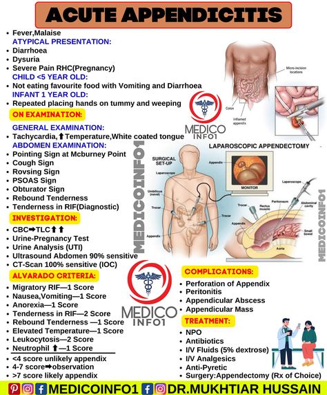 Acute Appendicitis #medicoinfo1 #medical #medicalstudent #medicalschool #medicine #medico #mbbs #mbbsstudent #mednotes #pharmacology #physiology #pathology #anatomy #microbiology #health #usmle #doctor #nurse General Surgery Notes, Appendix Surgery, Medical Laboratory Science Student, Medical Mnemonics, Nursing School Essential, Medicine Notes, Basic Anatomy And Physiology, Nurse Study Notes, Nursing Student Tips