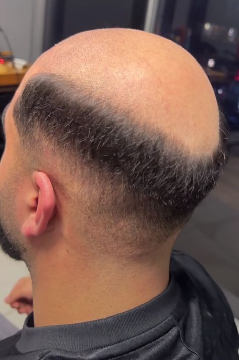 Follow @bald142 and get more of the good stuff by joining Tumblr today. Dive in! Male Pattern Baldness Hairstyles, Bald Look, Male Pattern Baldness, Pattern Baldness, Beards, Dive In, Shaving, The Good, Good Things