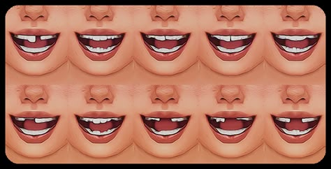 Growing Pains Child Teeth Set | Patreon Teeth Collection, Sims 4 Presets, Sims 4 Skin Details, Sims 4 Custom Content Patreon, Sims 4 Skin, Sims 4 Cas Cc, Sims Packs, Sims 4 Anime, Sims 4 Children