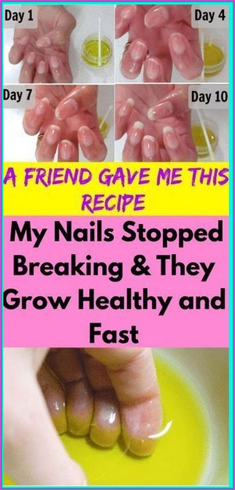 Big Nails, Creating A Newsletter, Nail Growth, Beauty Games, Strong Nails, Natural Beauty Tips, My Nails, Health Facts, Health Remedies