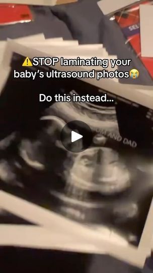 795 reactions · 88 shares | Primegeg on Reels | theprimegeg · Original audio | Reels Ultrasound Video, Video Frame, Everything Will Be Fine, First Ultrasound, Baby Ultrasound, Baby Things, Ultrasound, Love At First Sight, Pregnancy Announcement