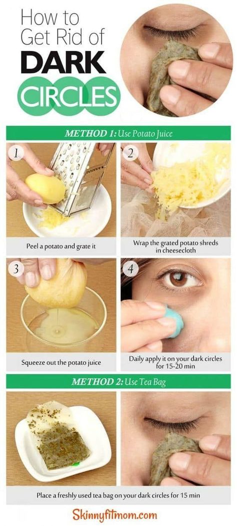 Dark Circle Remedies, Potato Juice, Dark Circles Under Eyes, Under Eyes, Remove Dark Circles, Beauty Remedies, Skin Remedies, Skin Care Remedies, Beauty Skin Care Routine