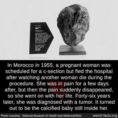 Paranormal Facts, Scary Facts, Creepy Facts, Unbelievable Facts, Pinterest Memes, Knowledge And Wisdom, Science Facts, Top Funny, True Facts