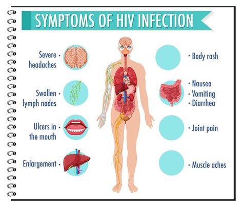 Symptoms of HIV infection infographic Symptoms Of Hiv, Aids Symptoms, Hiv Symptoms, Body Rash, Aids Virus, Hiv Aids Awareness, Aids Awareness, Study Related, Aids Day