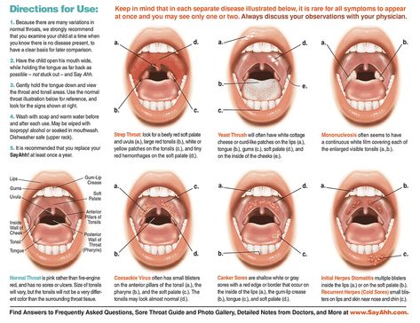 How to tell if your kids have a sore throat or not... Toddler Sore Throat, Sore Throat Kids, Scalp Sores, Sore Throat Remedies For Adults, Home Remedies For Sore Throat, Heal Sore Throat, Throat Soothing, Throat Tea, Sores On Scalp