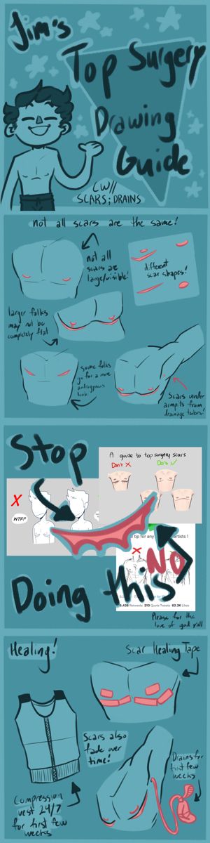 Top Scar Drawing, Top Surgery Drawing Reference, Trans Scar Reference Drawing, Top Surgery Scar Designs, Draw Burn Scars Reference, Healed Scar Reference, Leg Bandages Drawing Reference, Scar Color Reference, Top Surgery Art Drawing