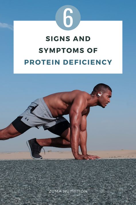 What Are the Signs and Symptoms of Protein Deficiency? Protein Deficiency Symptoms, Protein Deficiency, Deficiency Symptoms, Daily Protein, Vitamin B12 Deficiency, Take Care Of Your Body, Heart Problems, Pictures Of People, Signs And Symptoms