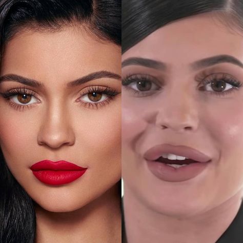 INSTAGRAM VS REALITY KYLIE JENNER  #kyliejenner #instafashion #instadaily #music #instalike #hollywood #face #instapic #instamood #beauty… Kylie Jenner Reality Vs Instagram, Kylie Jenner Surgery, Kardashian Jenner Sisters, Reality Vs Instagram, Life Of Kylie, Facial Procedure, Instagram Vs Real Life, Instagram Vs Reality, Good Kisser