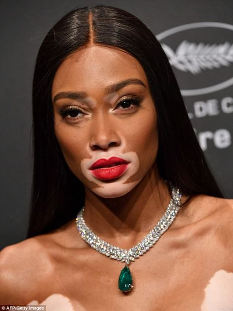 This is my moment: Winnie has become a household name in the fashion industry after findin... Chantelle Brown Young, Winnie Harlow, Happy Bday, Model Face, Luxury Makeup, Red Lipstick, Mini Velvet Dress, Fenty Beauty, Kylie Cosmetics