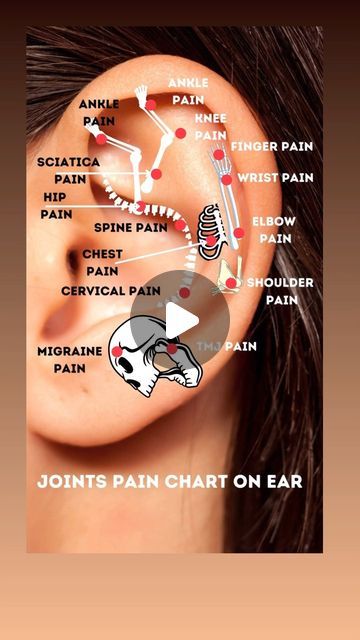 Dr. Aadil Khan on Instagram: "Ear acupuncture points have been widely known to relieve the pain associated with this physical issue. Acupuncture points on the ears may help relieve pain and tension around the body. Activating pressure points in the ear may help ease symptoms of several conditions.  #ear #auricular #acupuncture #acupressure #health #pain #organschart #organspoint #jointpain #ankle #shoulder #migraine #tmj #chest #wrist #ankle #knee #sciatica #cervical #acupuncturistaadilkhan   Disclaimer: This content is for educational purposes only and is not a substitute for professional medical advice. Please consult a doctor for any health concerns.  Disclaimer: Reposting this content without permission is prohibited. Please contact us for authorization." Ear Acupuncture Points, Ear Acupressure Points, Auricular Acupuncture, Body Pressure Points, Ear Massage, Ear Seeds, Ear Acupuncture, Itchy Ears, Acupuncture Benefits