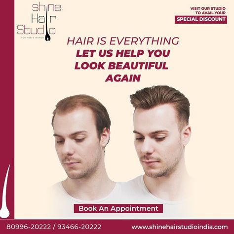 Our hair patches are specifically designed to make you look your best and help boost your self-confidence. We are a team of professional stylists dedicated to helping men regain their confidence through new hair-fixing services. Get More Details, Book your appointment today! |+91 9346620222 | +91 8099620222 | +919705720222 | +91970582222 Studs For Men, Hair Fixing, Hair Clinic, Professional Stylist, We Are A Team, Hair Transplant, Book Your Appointment, Look Your Best, Ad Design