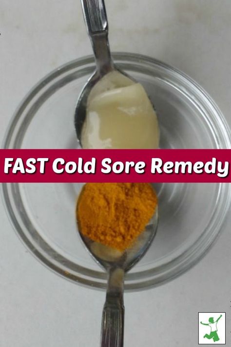 Cold sores or fever blisters, most people get them. There are some wonderful natural remedies to help with the cold sores. Come find out about three fast cold sore remedies that you could be using today! #coldsores #coldsoreremedies #coldsoreremedy #feverblisters #feverblisterremedy #feverblisterremedies #naturalremedies #mrsjonescreationstation Cold Sore Remedy Fast, Heal Cold Sores Fast, Cold Remedy Tea, Fever Blister Remedy, Cold Sore Remedies, How To Heal Blisters, Baby Cold Remedies, Natural Cold Sore Remedy, Home Remedies For Fever