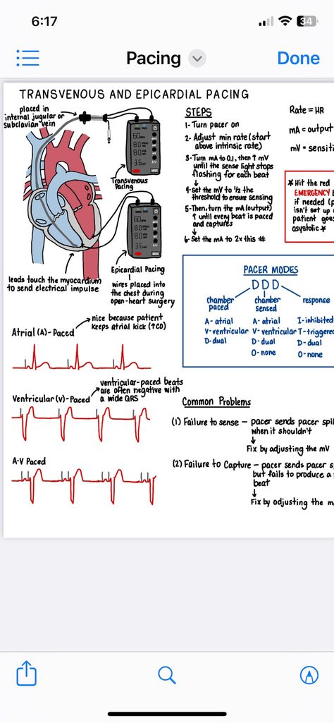 Cardiac Critical Care Nursing, Cardiovascular Notes, Medical Assistant Notes, Respiratory Therapy Notes, Paramedic Study, Telemetry Nursing, Cardiac Rehab, Emt Study, Crna School