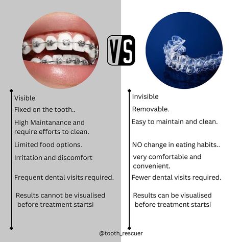 Metal braces vs. Invisalign: Which is right for you? Dive into the differences and discover your perfect smile solution! #BracesVsInvisalign #SmileJourney #toothrescuer #gibekhaa #dental #dentists #painfree #metalbraces #clearalligners #dentalalligners #smile #easy #beautiful Braces Clear, Invisalign Aligners, Teeth Alignment, Invisible Braces, Traditional Braces, Clear Braces, Clear Aligners, Metal Braces, Perfect Smile